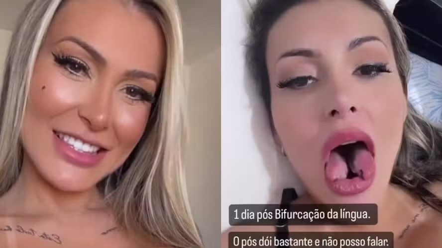 Andressa Urach choca a web ao mostrar língua bifurcada Aumento de