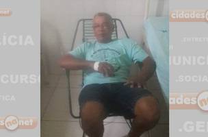 Professor sofre queimaduras ao tentar controlar princípio de incêndio no Piauí (Foto: -)