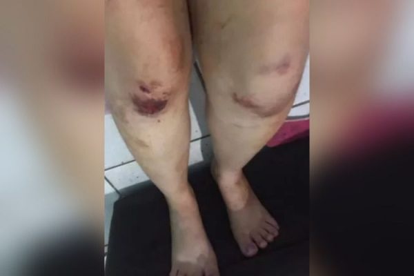 Mulher denuncia que foi agredida durante show de Eduardo Costa