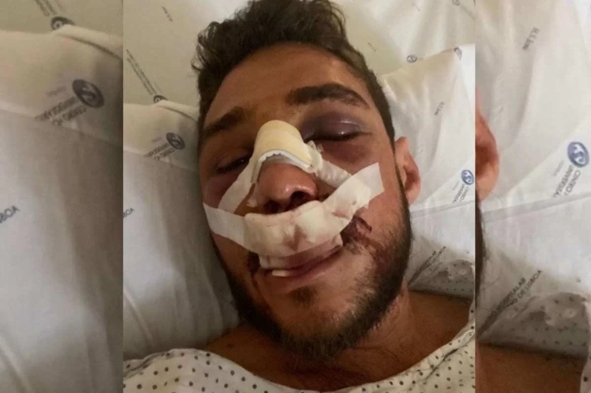 Brasileiros são espancados por seguranças dentro de bar de Portugal