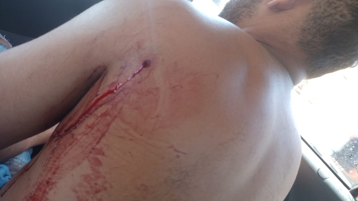 O motorista foi baleado durante uma tentativa de assalto