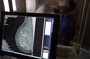 Veja como fazer o tratamento do cancer (Foto: INSS)