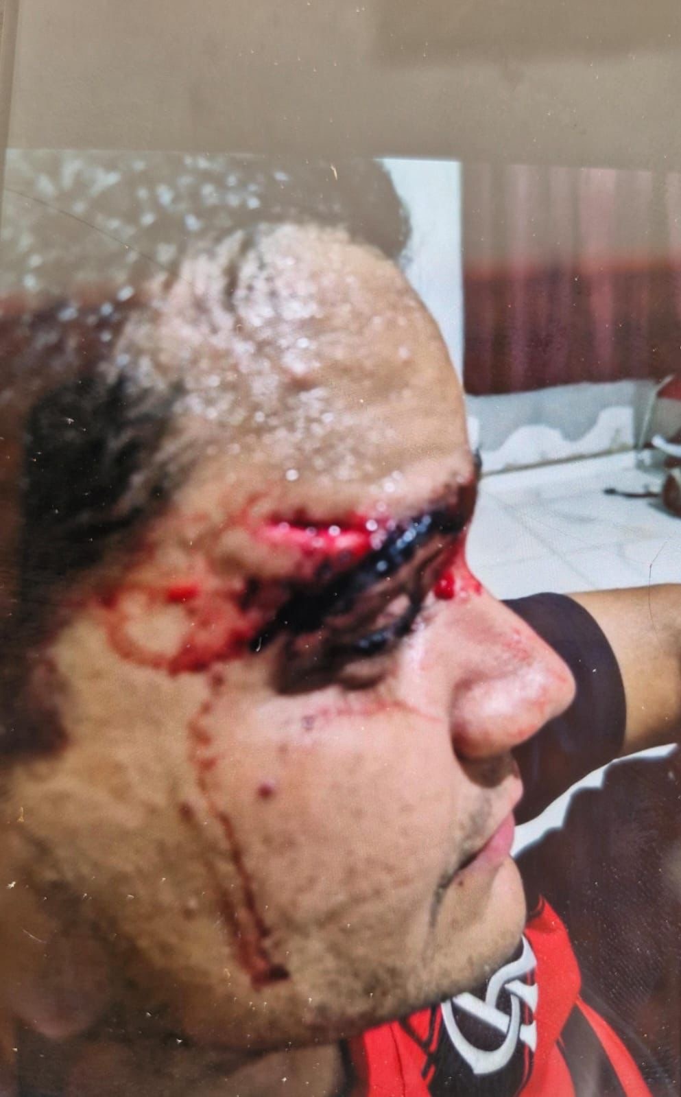 Esse é o filho do vice prefeito de Luzilandia' atingido pelo carro da filha da deputada quando dormia em casa