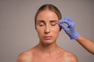 blefaroplastia (Foto: Divulgação)