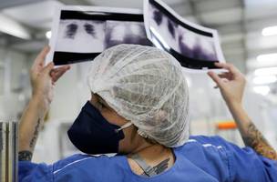A doutora Luciana Souza compara duas radiografias de tórax diferentes de um paciente enquanto conversa com um colega de um hospital de campanha criado para tratar pacientes que sofrem da doença de coronavírus (COVID-19) em Guarulhos, São Paulo (Foto: © REUTERS / Amanda Perobelli/Proibida reprodução)
