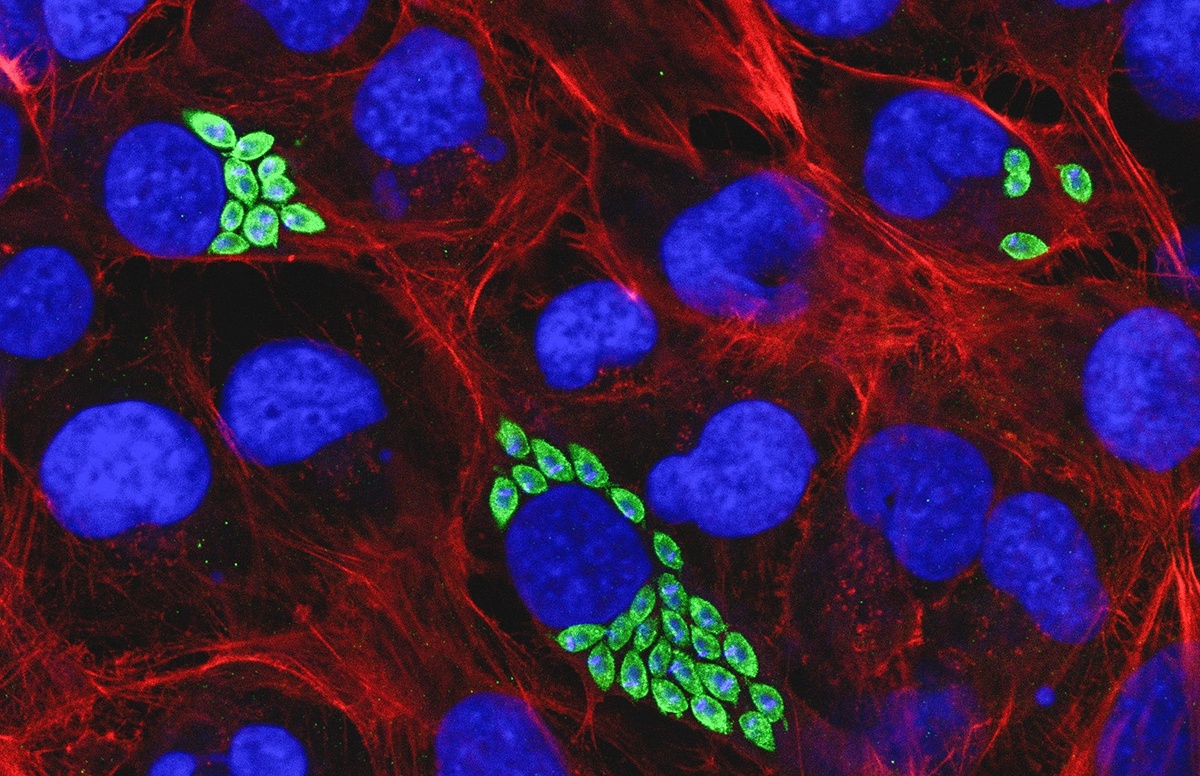 Células cardíacas infectadas pelo Trypanosoma cruzi, com núcleos destacados em azul, citoesqueleto em vermelho e parasitas em verde.
