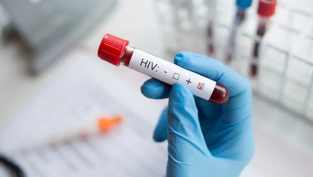 Estudo aponta remissão do HIV após transplante com doador familiar