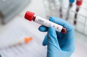 Estudo aponta remissão do HIV após transplante com doador familiar (Foto: Reprodução)