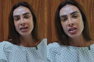 Nicole Bahls realiza transplante capilar (Foto: (Reprodução/Instagram @nicolebahls))