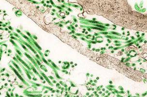 Vírus do Ebola visto no microscópio (Foto: IMAGE POINT FR/NIH/NIAID/BSIP/Universal Images Group via Getty Images)