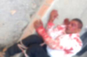 Suspeito foi amarrada e espancado por moradores da região (Foto: Reprodução)