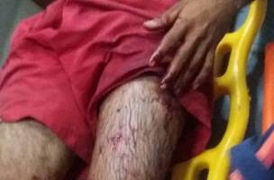 Homem de 32 anos é baleado em praia no litoral do Piauí (Foto: -)
