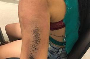 Boate na zona Leste onde jovem sofreu queimaduras é multada em R$ 5 mil (Foto: -)