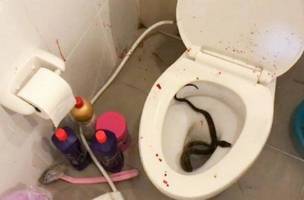 Jovem é picado no pênis por píton ao se sentar em vaso sanitário (Foto: -)